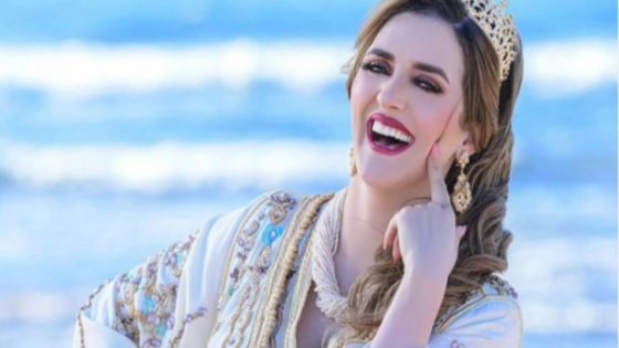 نرجس الحلاق ترد على السخرية بشأن مظهرها السابق – صورة