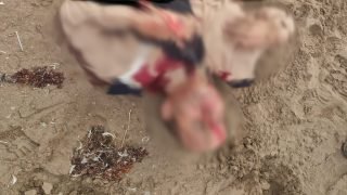 الدار البيضاء..اعتداء بالسلاح الأبيض يستهدف عنصراً من القوات المساعدة بعين الذياب